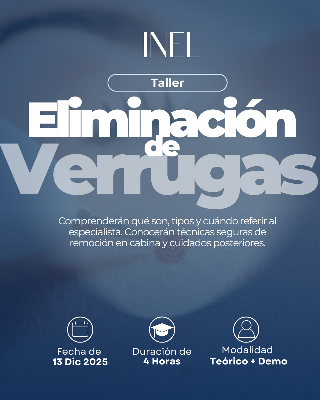 Taller Eliminación de Verrugas